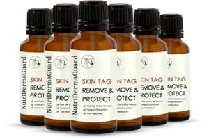 NutriDermaGuard Skin Tag Remover 